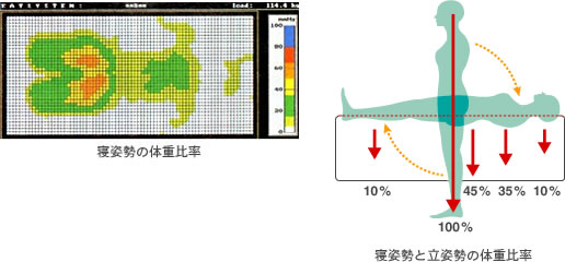 体圧分散